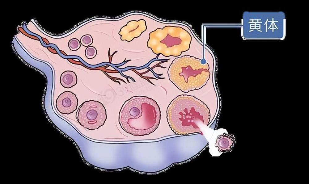 一天接了2个急诊,都是黄体破裂,黄体到底是什么?女性该知道