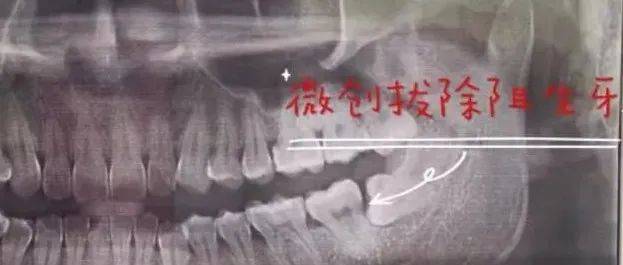省级口腔颌面外科专家支援口腔科_云南省_鹤庆县_服务