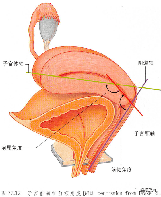 男性子宫图片