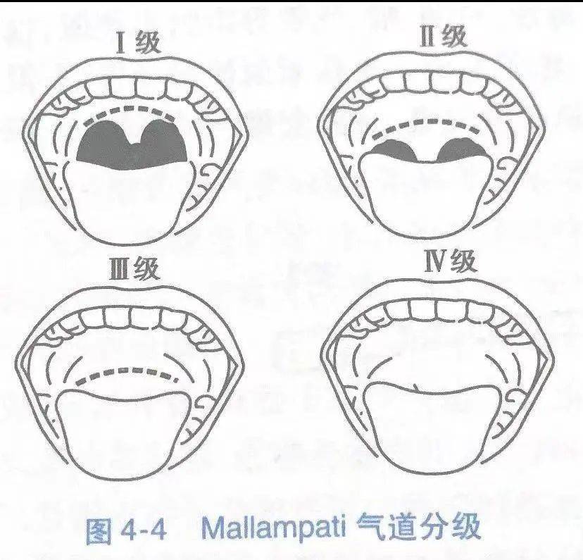 支气管的分级 图图片