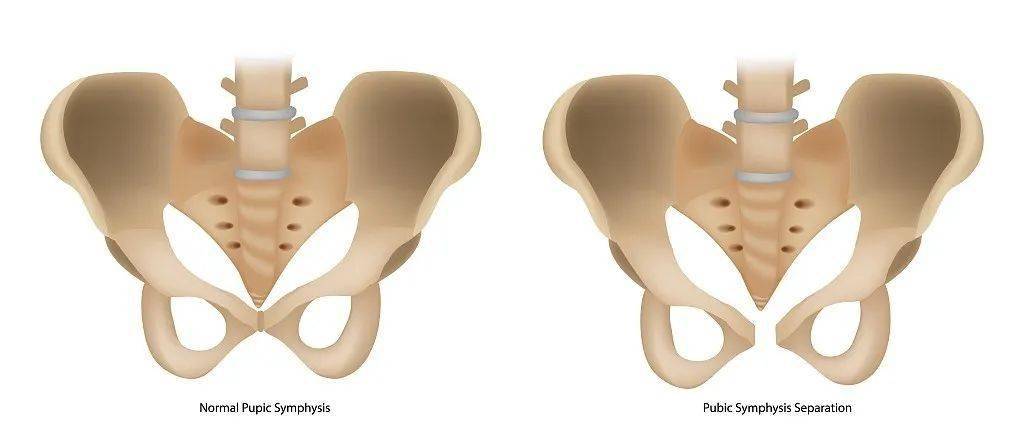 孕妇_骨盆_方法