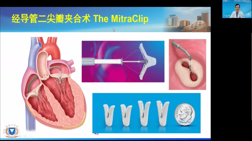 浙江省人民医院超声科成功举办2022经食管超声心动图基础学习班