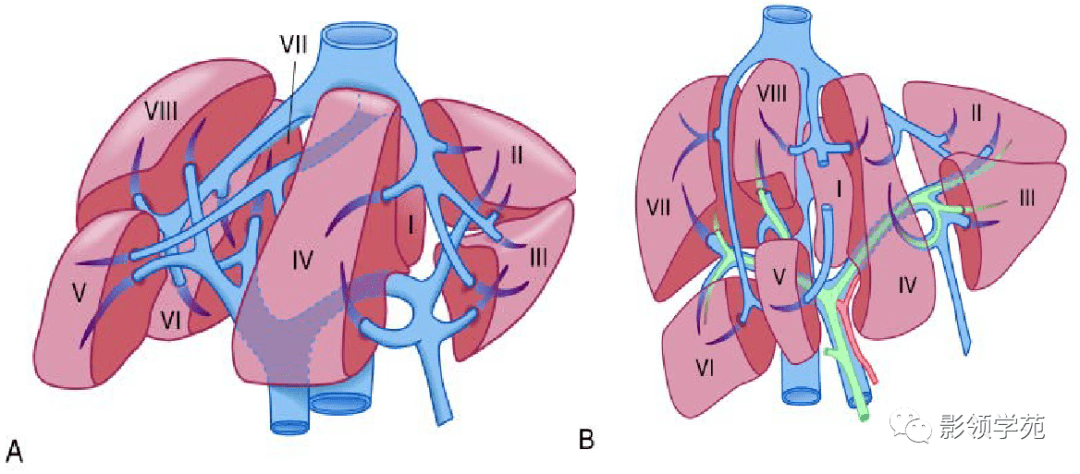 段彼此之间的界限为肝裂肝裂在肝内管道的铸型标本上,显示缺乏glisson