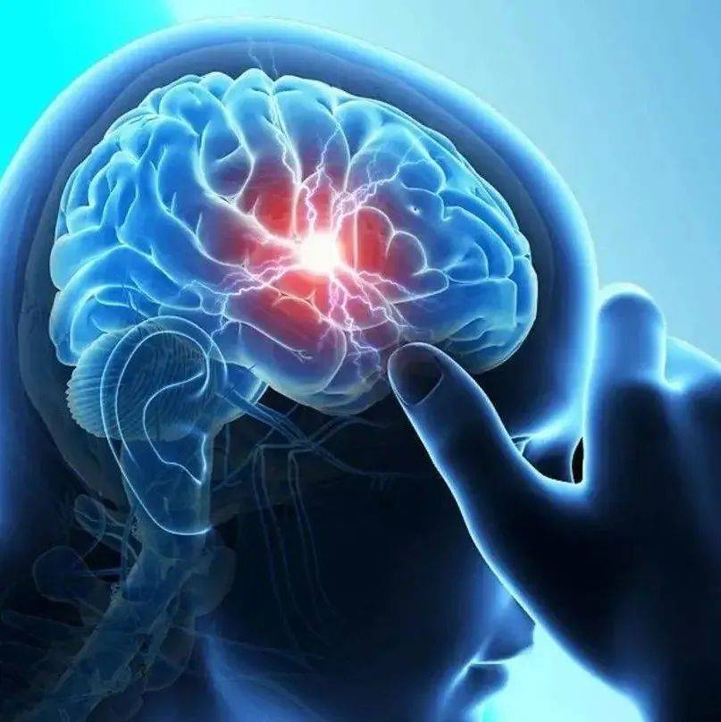 Stroke丨急性卒中与预期寿命显著减少相关_风险_患者_死亡
