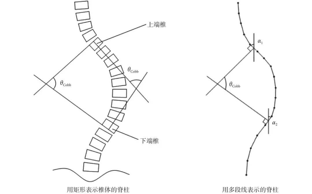 脊柱侧弯厘米对照表图片