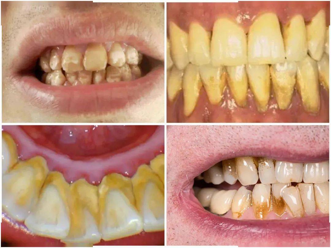 我替你们问了医生_牙齿_效果_品牌