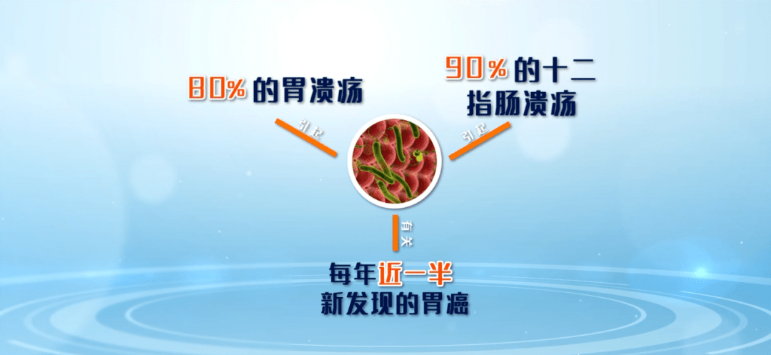 十二指肠溃疡检查报告图片