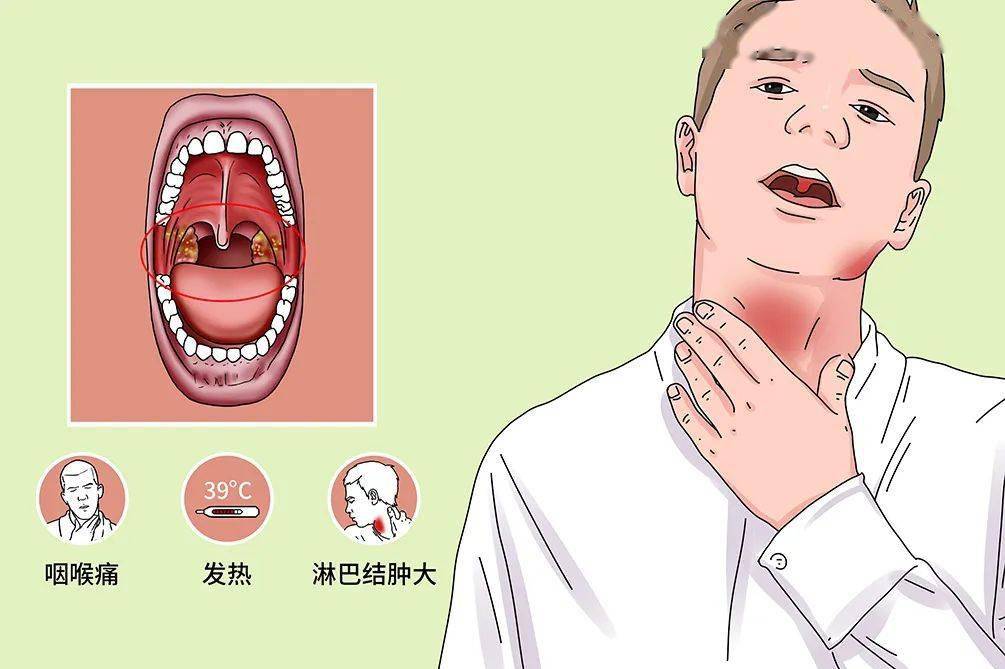 症状:长期喉痛,喉头发红,吞咽困难,喉咙异物感,阵发性咳嗽,早起干呕