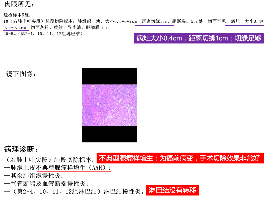 如何看懂肺癌【病理报告】?