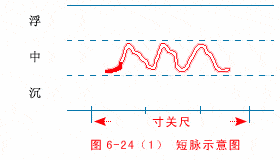 中医把脉手把手教,最全动图展示并心法口诀!_脉象_部位_实证