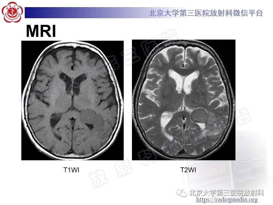 头颈系统超全影像文章汇总全网最全头颅影像解剖学,不容错过(更新版)
