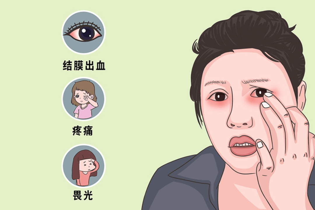 中工作知道自己是被电焊晃了眼这些患者有的从事电焊工作他们双眼疼痛