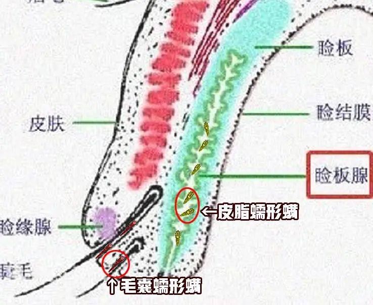 睫毛毛囊中,而相对娇小的皮脂蠕形螨则能深入至眼睑的皮脂腺和睑板腺