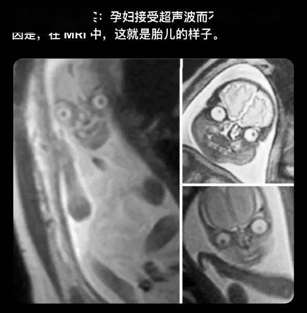 哪有什么岁月静好