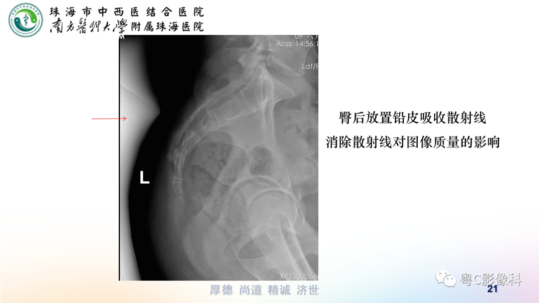 骶尾骨x线解剖图片