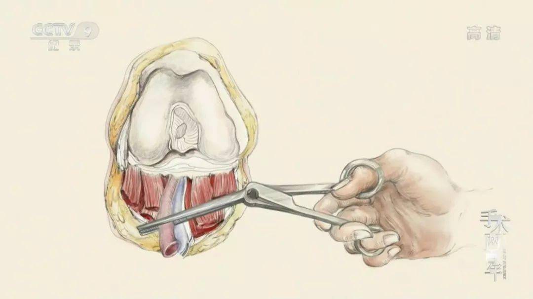 解剖手术女子图片