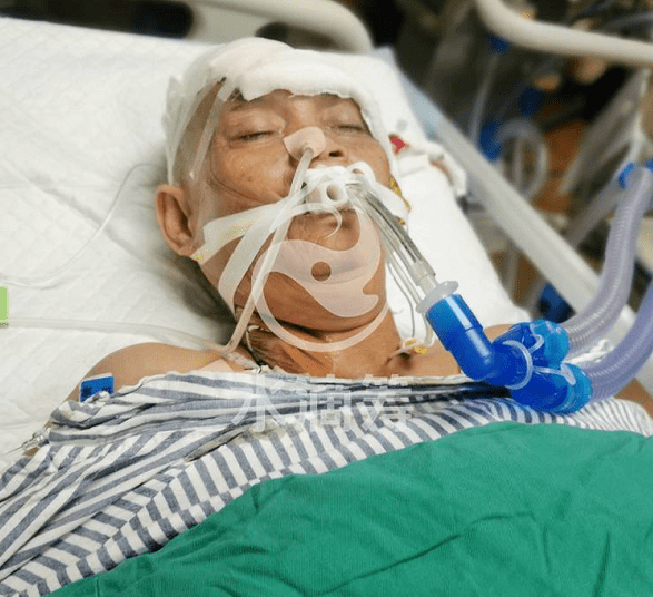 高州靓女求助:儿早产,母亲意外脑出血病重术后icu,雪上加霜