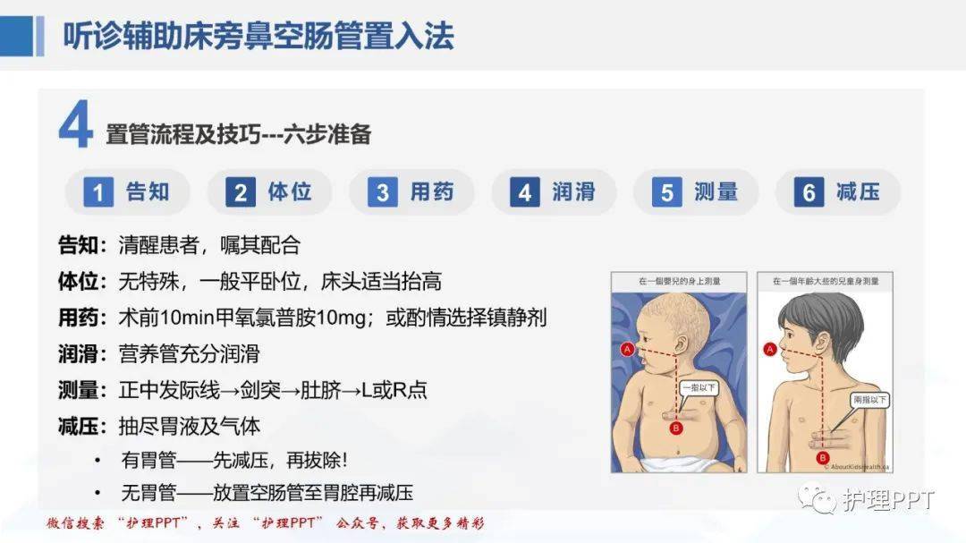 ppt鼻肠管的留置及维护