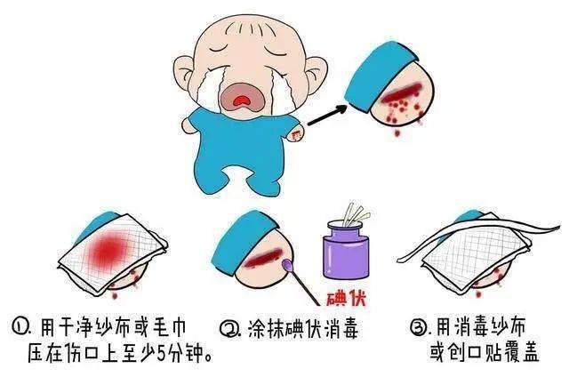 幼儿受伤流血卡通图片图片