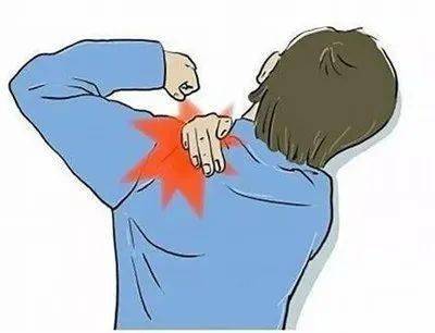 中医小小竹罐解决大问题,特色康复疗法巧治中风后肩手综合征!