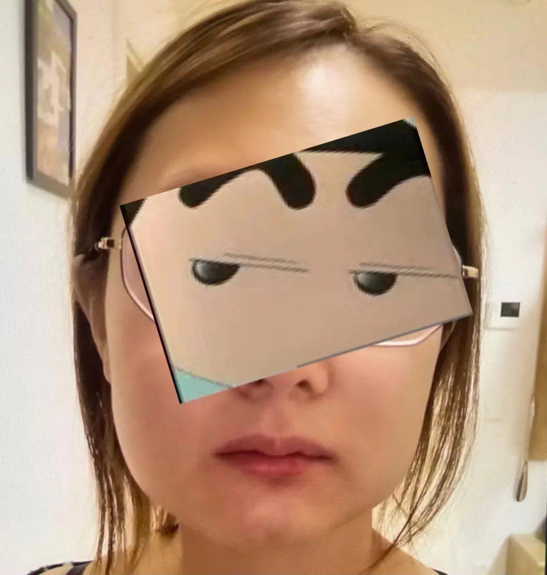 明星拔智齿是可爱你拔智齿是人间疾苦