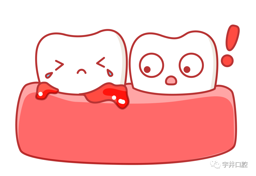 牙龈出血不要怕!_牙齿_炎症_治疗