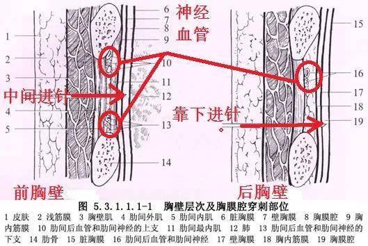 肋下动脉解剖图图片