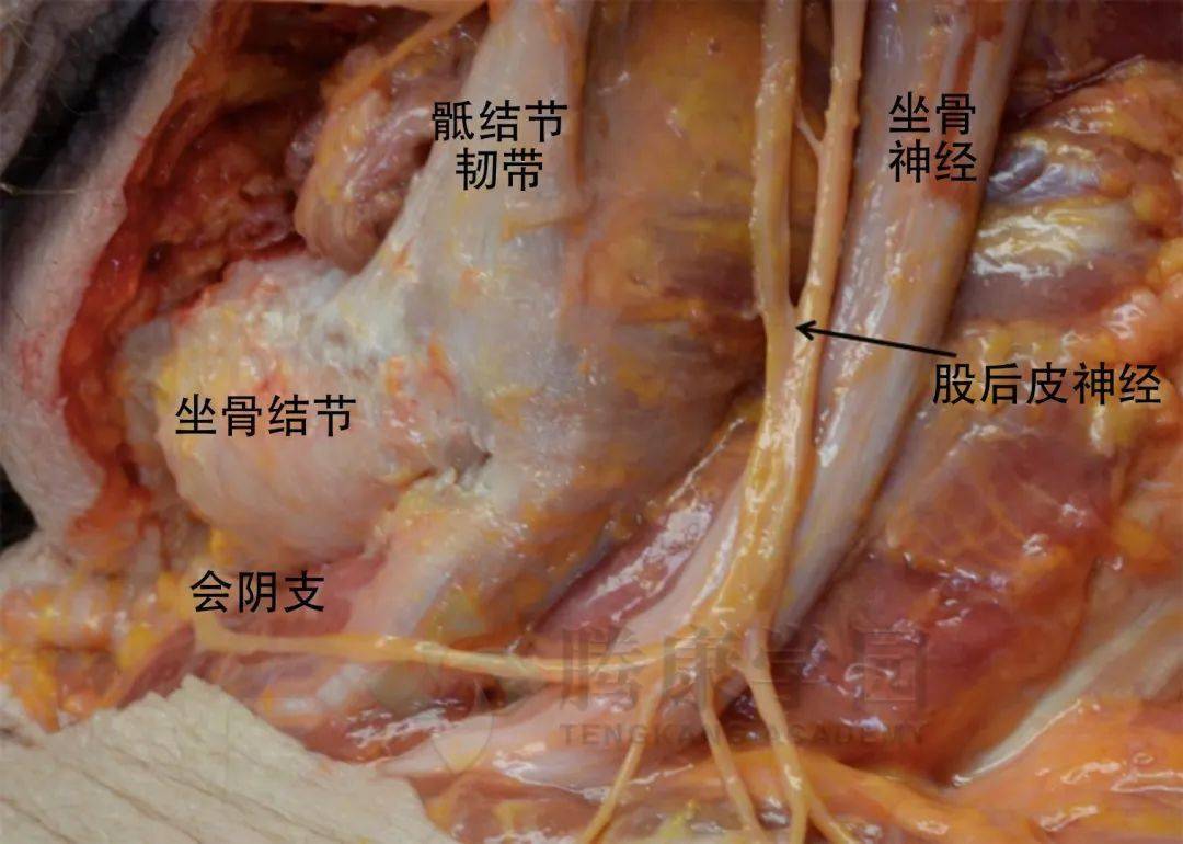 支配大腿内侧和外侧会阴的股后皮神经会阴分支出现在坐骨结节远端 2