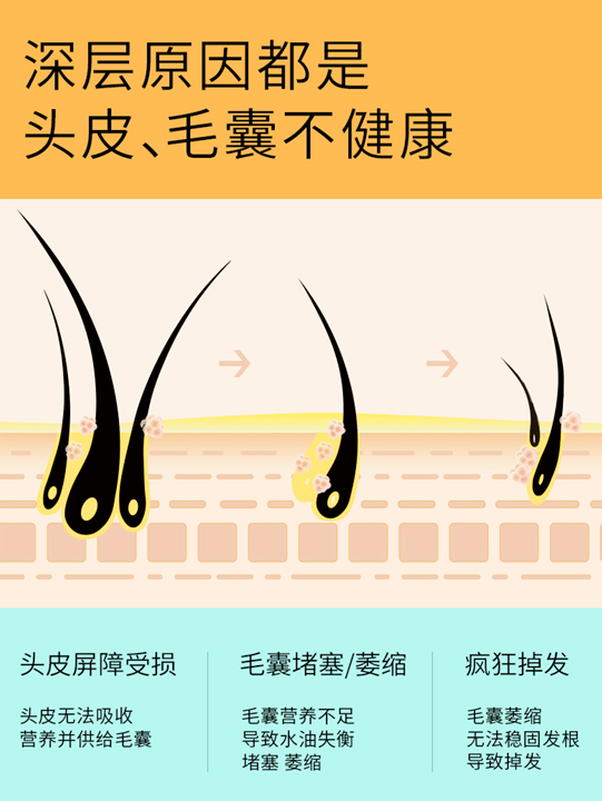 正常的新陈代谢过程,每个人每天都会掉50