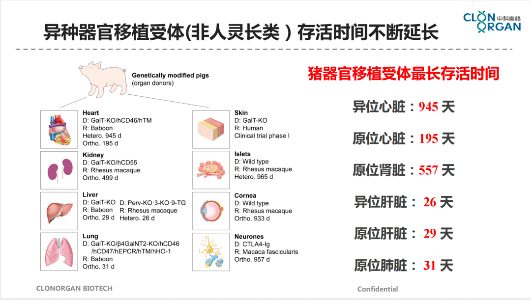 猪心脏移植,离我们还有多远?_器官_潘登科_病人
