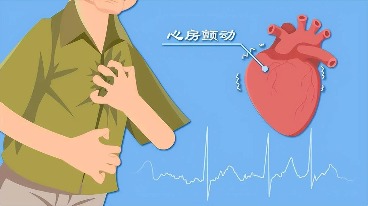 心房颤动(房颤)是一种常见的心律失常.