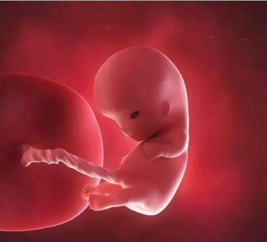 怀孕三个月的胎盘图片图片