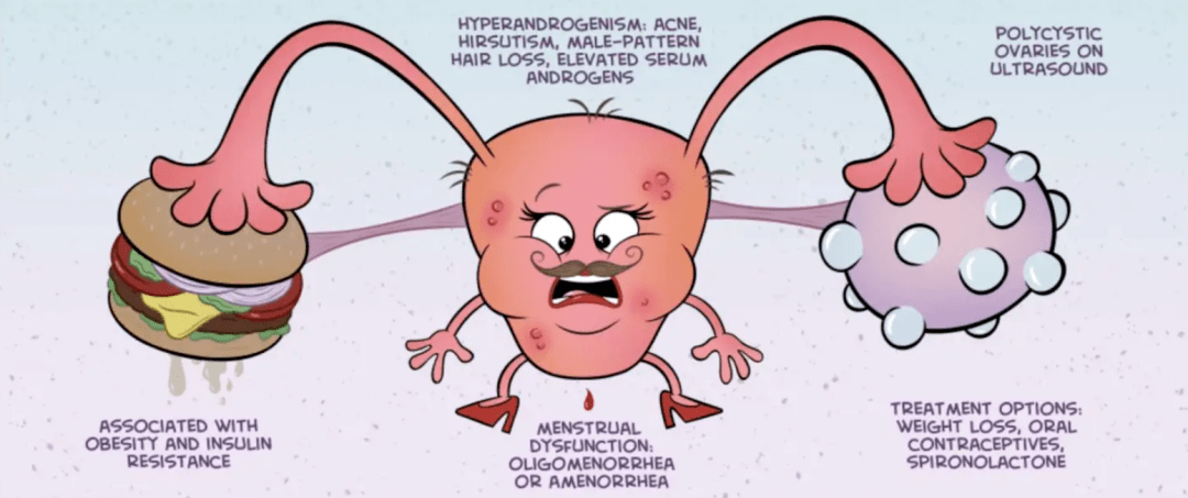 女性高雄激素血癥_卵巢_腎上腺_綜合徵