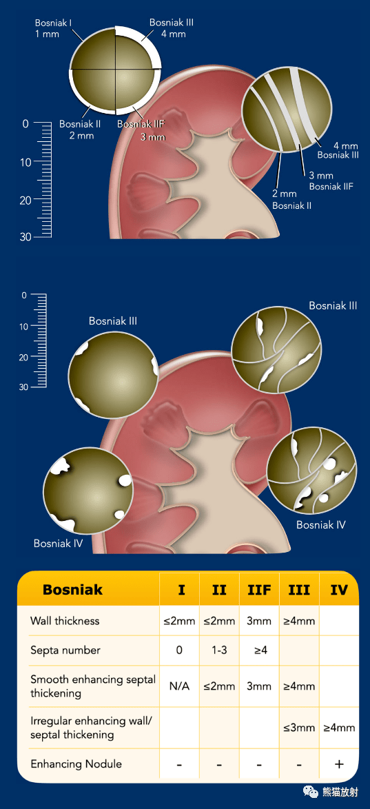 cysticartery图片