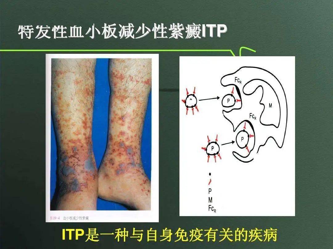 健康知识这种血液病患者要注意这些