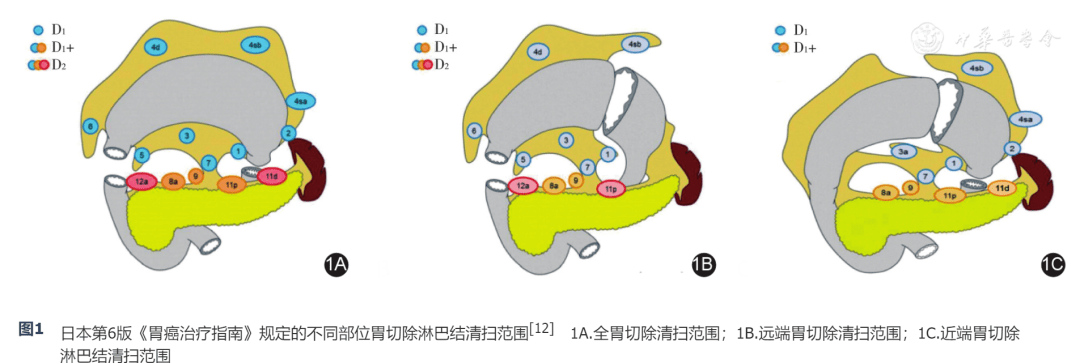 胃的淋巴结分组图片