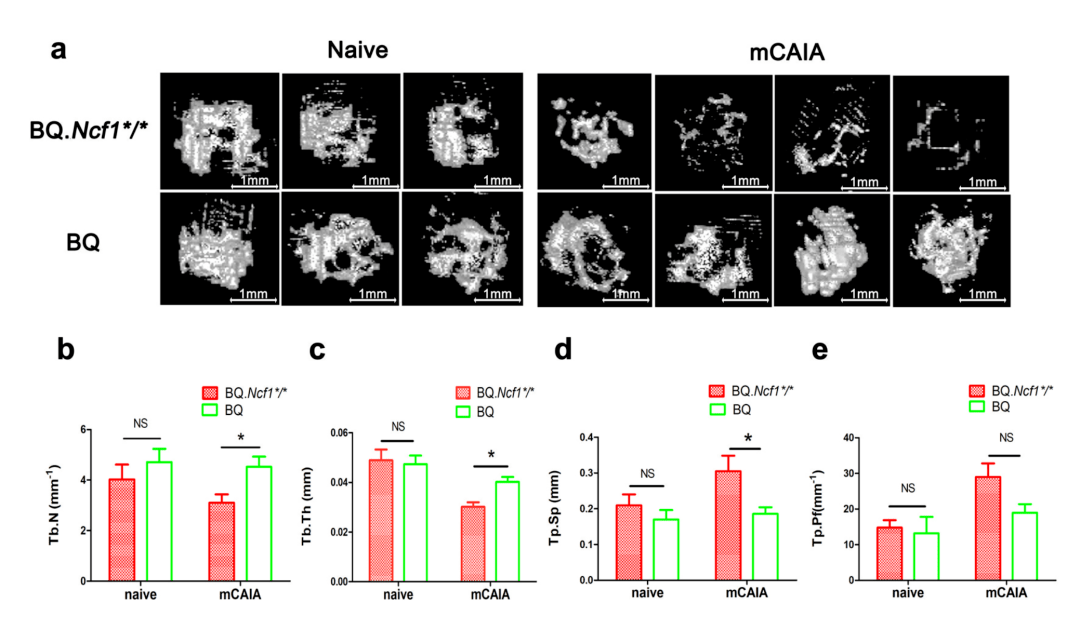 中性粒細胞胞漿因子1(neutrophil cytosolic factor 1,ncf1)參與了