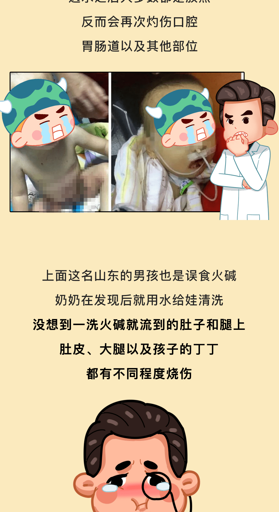 山东男童丁丁大面积烧伤或影响生育罪魁祸首竟是它别让娃碰