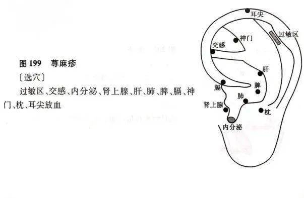 耳尖放血图解图片