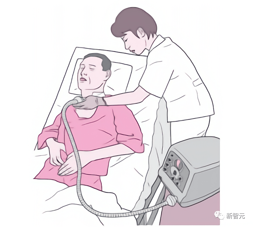 了渐冻患者经常遇到的问题——咳痰,每天只能借助咳痰机来帮助吸痰
