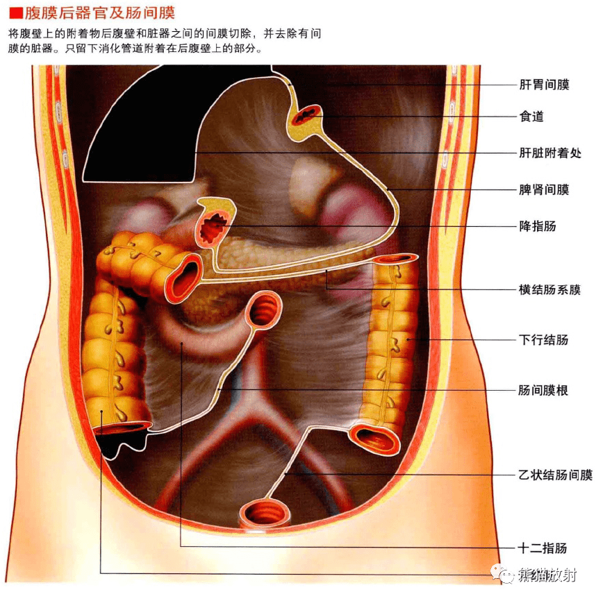 腹膜解剖图3d图片