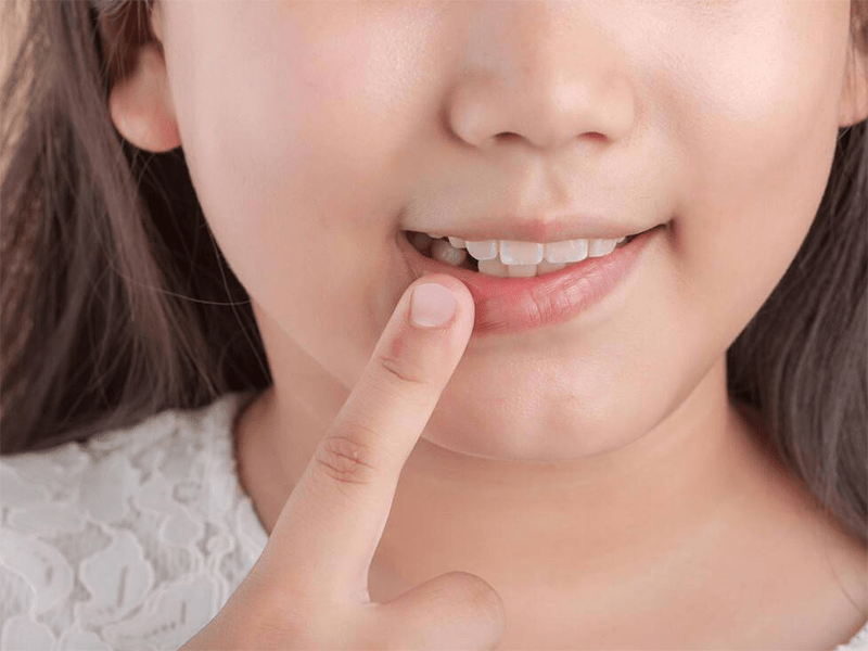 儿童换牙顺序(换牙年龄及注意事项)