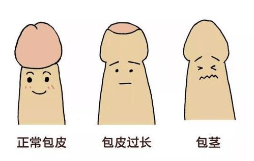 一般来讲,青春期时包皮和龟头就会自行分离,以后随着生长发育,阴茎