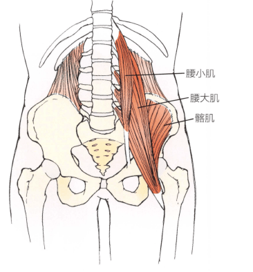 腰大肌,腰小肌和髂肌功能障碍:髂腰肌趋于卷曲形成一向内的扭转,这