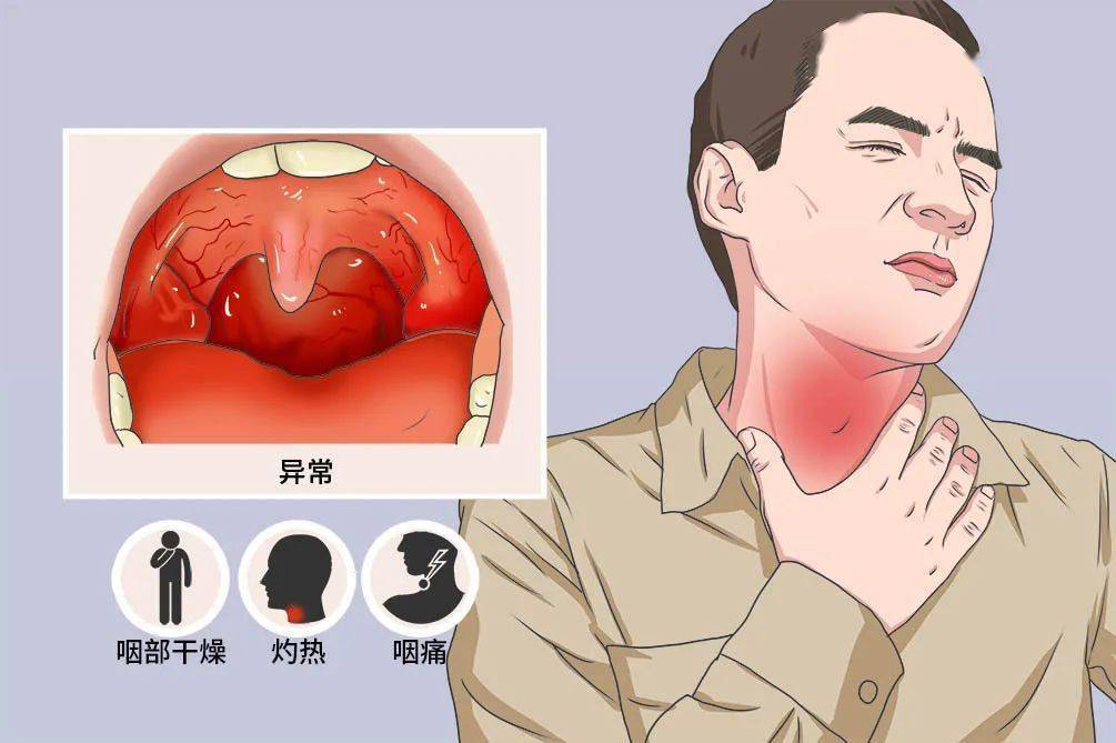 喉咙和咽喉的位置图片图片