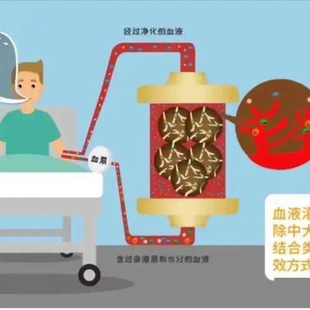 危急时刻！血液灌流技术显神威_毒物_患者_治疗