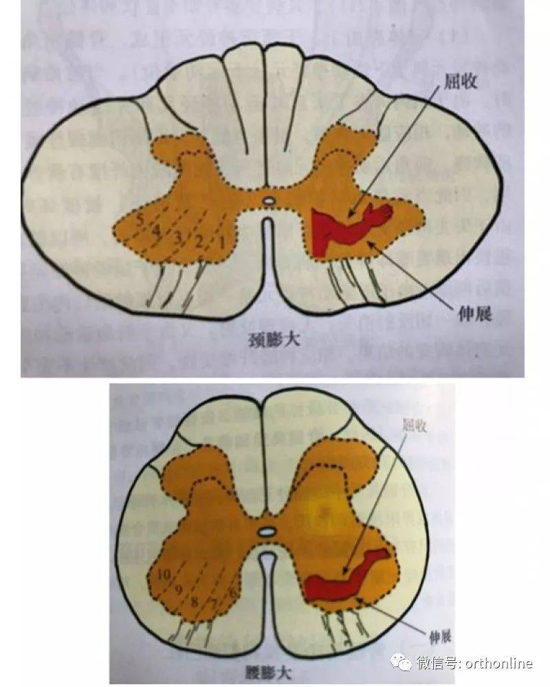 前角:下運動神經元損害 後索:亞急性聯合變性 前角受損:als單純:原發