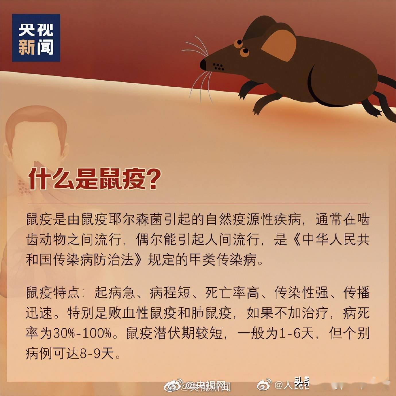 宁夏确诊一例腺鼠疫病例如何预防要点来了