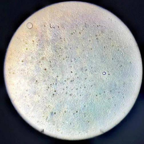 几例鸡布氏艾美耳球虫病的诊治_疫苗_进行_肠道