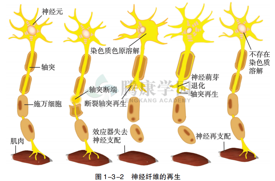 神經纖維在受到損傷後的第 2-3 周,該神經元胞體及其纖維出現結構和